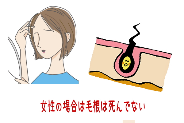 女性の薄毛
