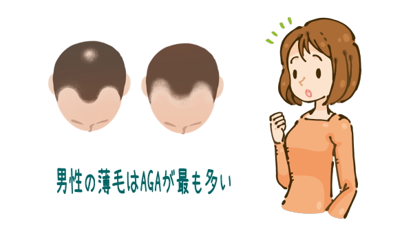 男性の薄毛