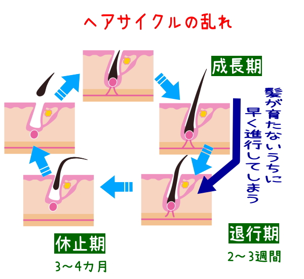 ヘアサイクルの乱れ